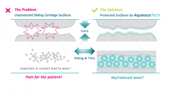 Img. 2: AqueousTech illustrated in the knee joint